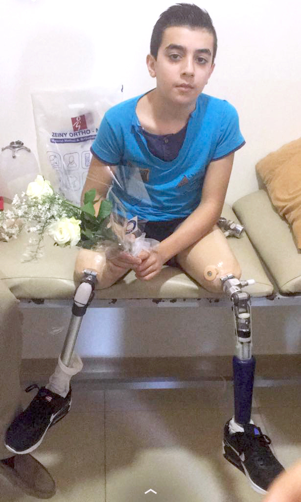 Kuwait Red Crescent Society (KRCS) paid the education and treatment expenses of a Syrian child, Qusai Khaleel Alloush, who has lost his legs during the war in Syria
