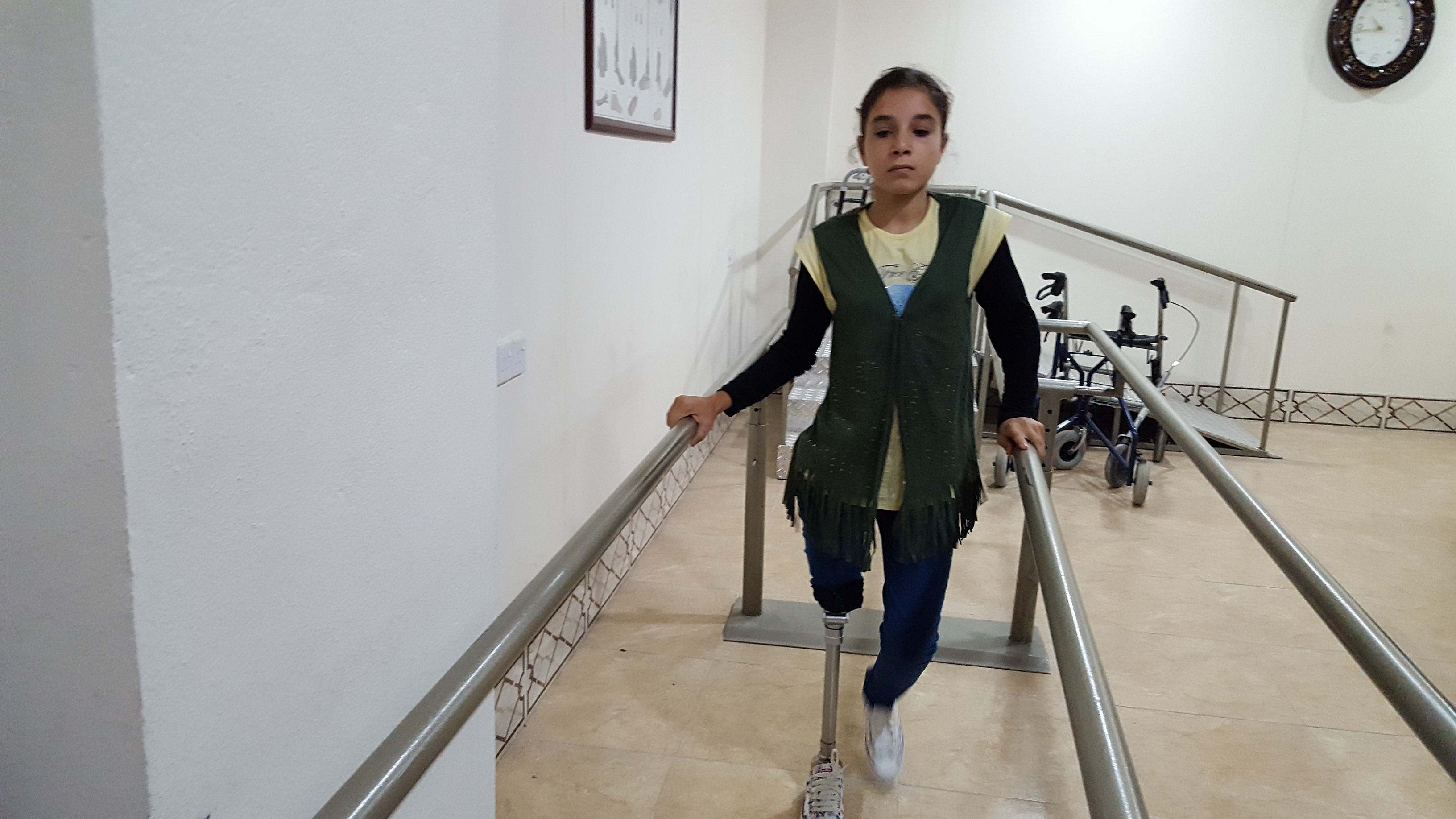 Kuwait adopts treating 180 Mosul's civilians with artificial limbs