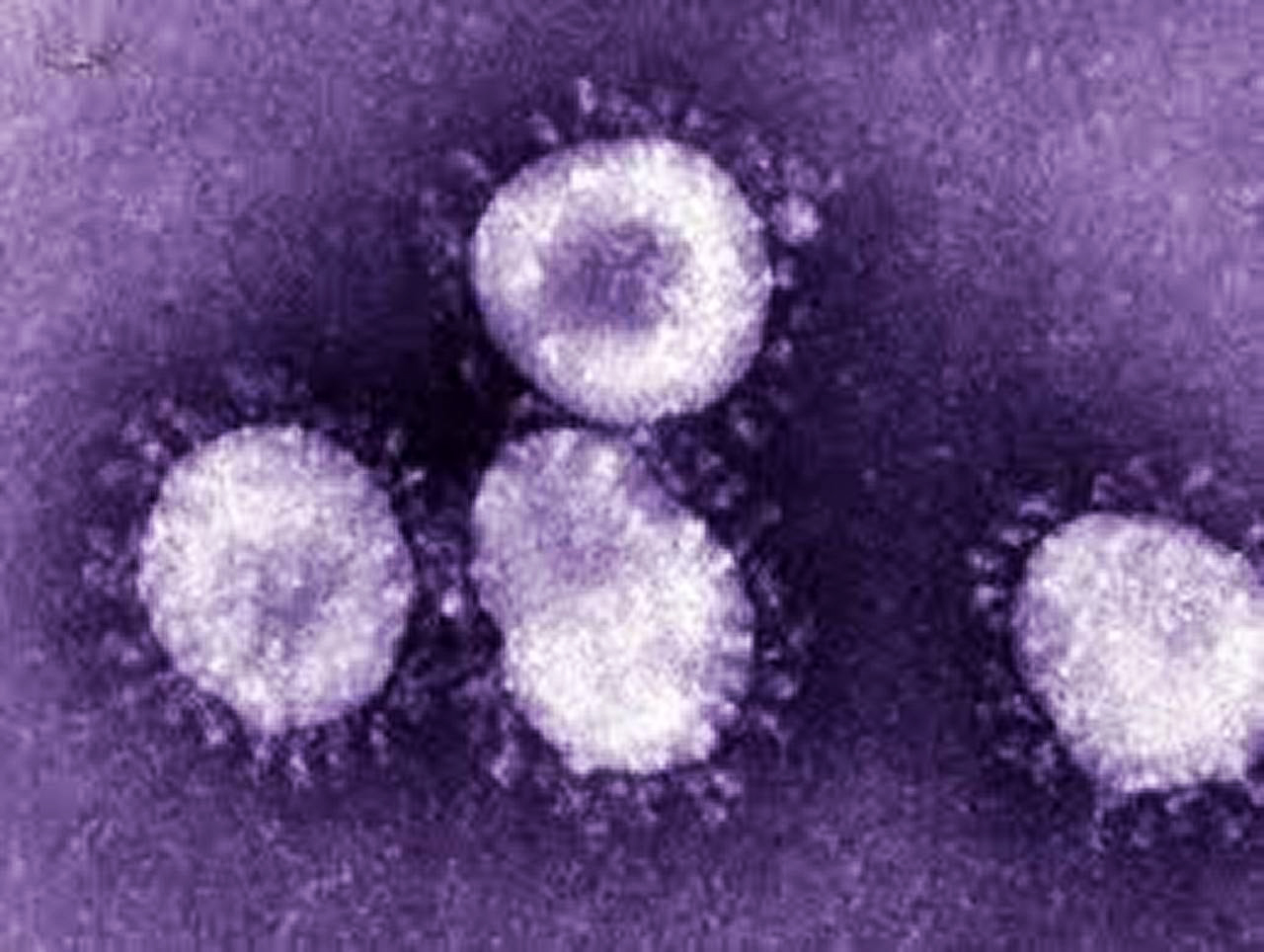 فيروس كورونا