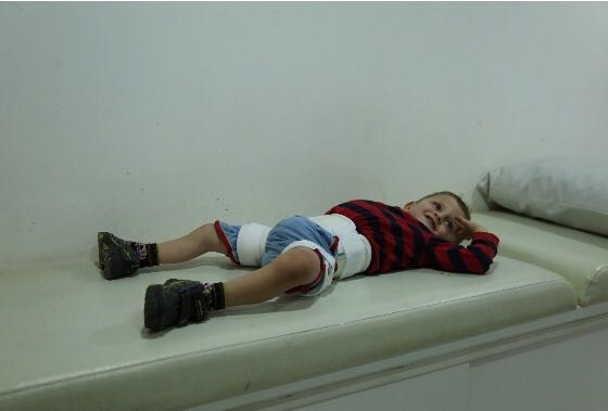 Kuwait Red Crescent Society (KRCS) launches in Lebanon a campaign to conduct prosthetic procedures on Syrian refugees with severed limbs