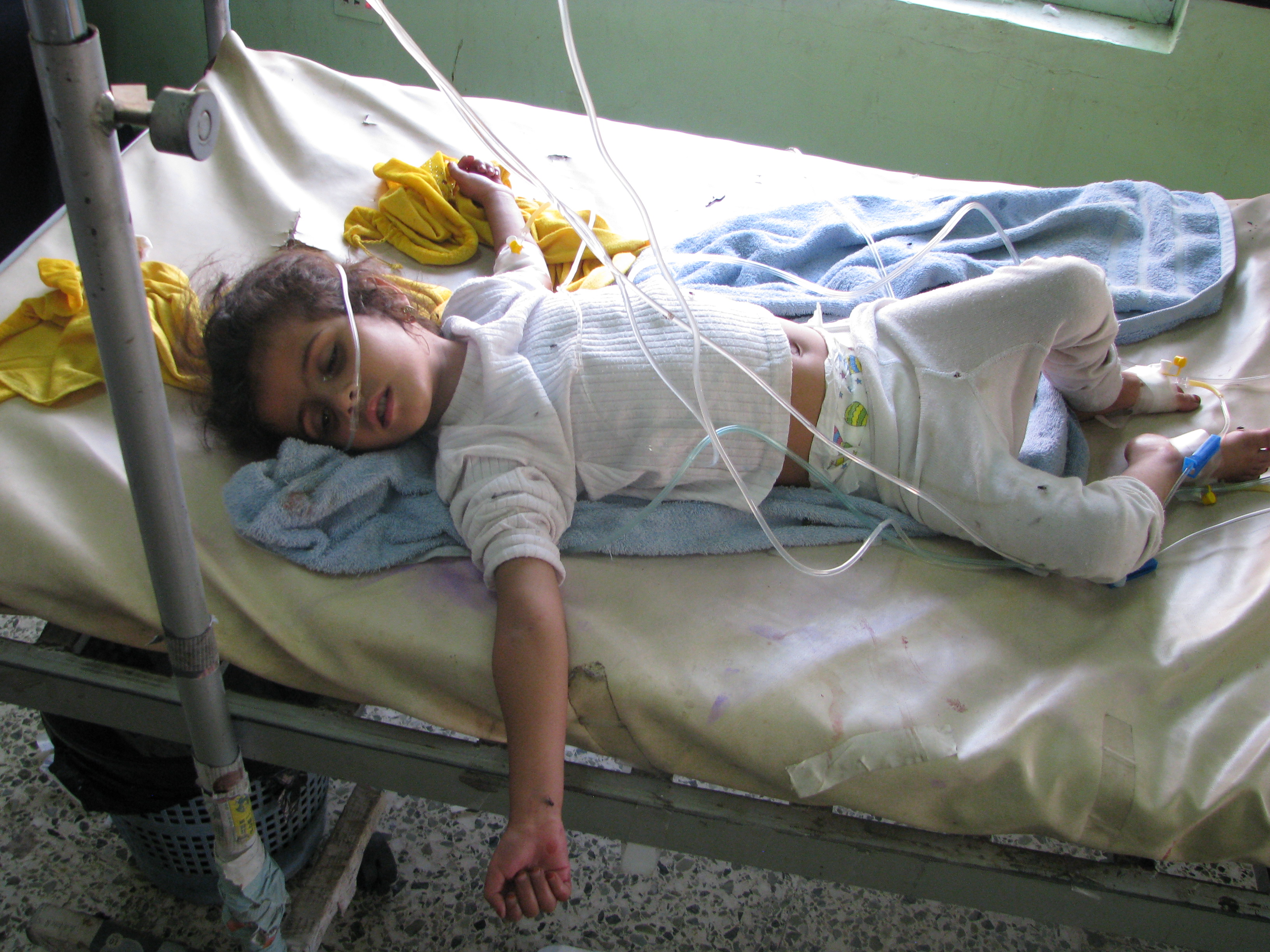 طفلة مصابة بالكوليرا تتلقى العلاج في المستشفى الجمهوري بتعز