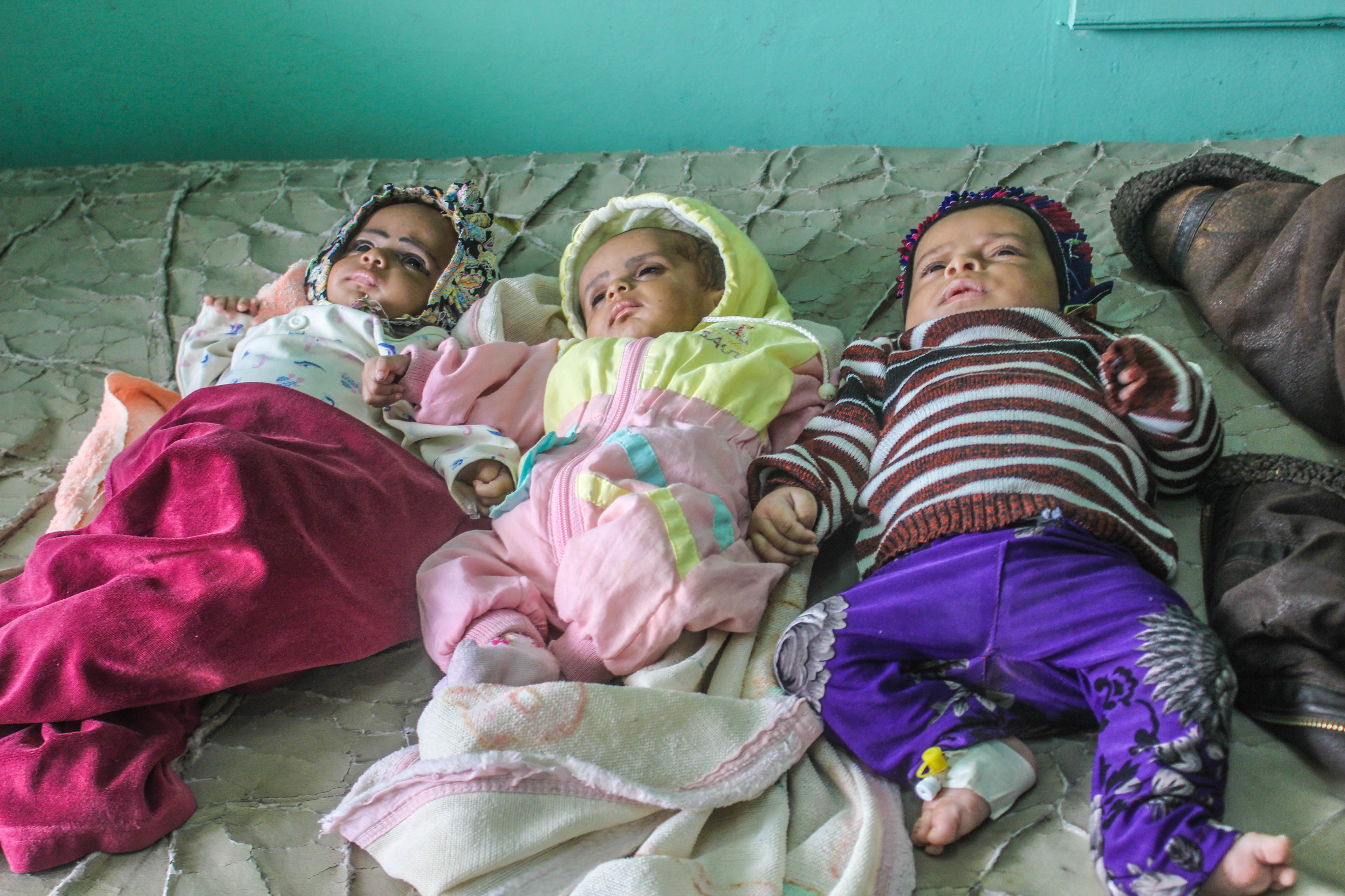 A twin and a third child in the hospital for the treatment of cholera in Taiz, Yemen