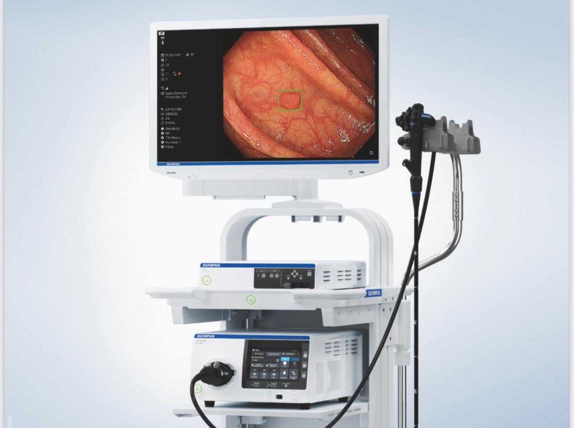 جهاز يستخدم الذكاء الاصطناعي للكشف عن الاورام