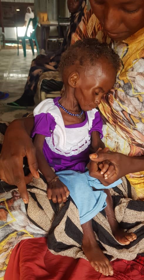 A child facing emergency levels of hunger in Sudan